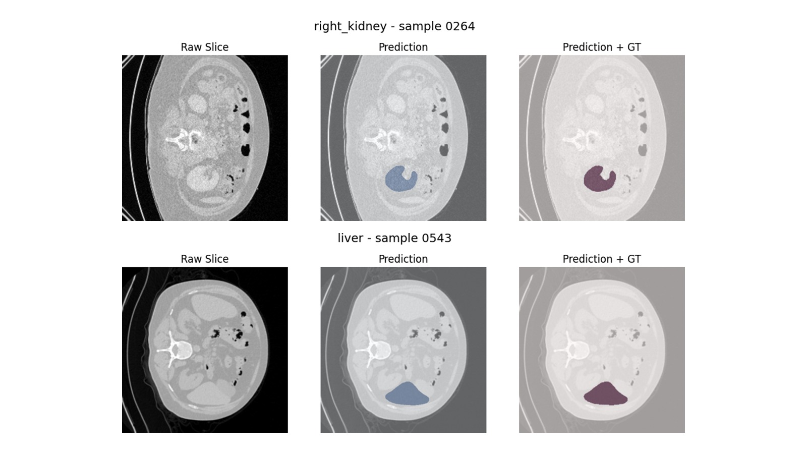 Kidney and Liver Segmentation Results