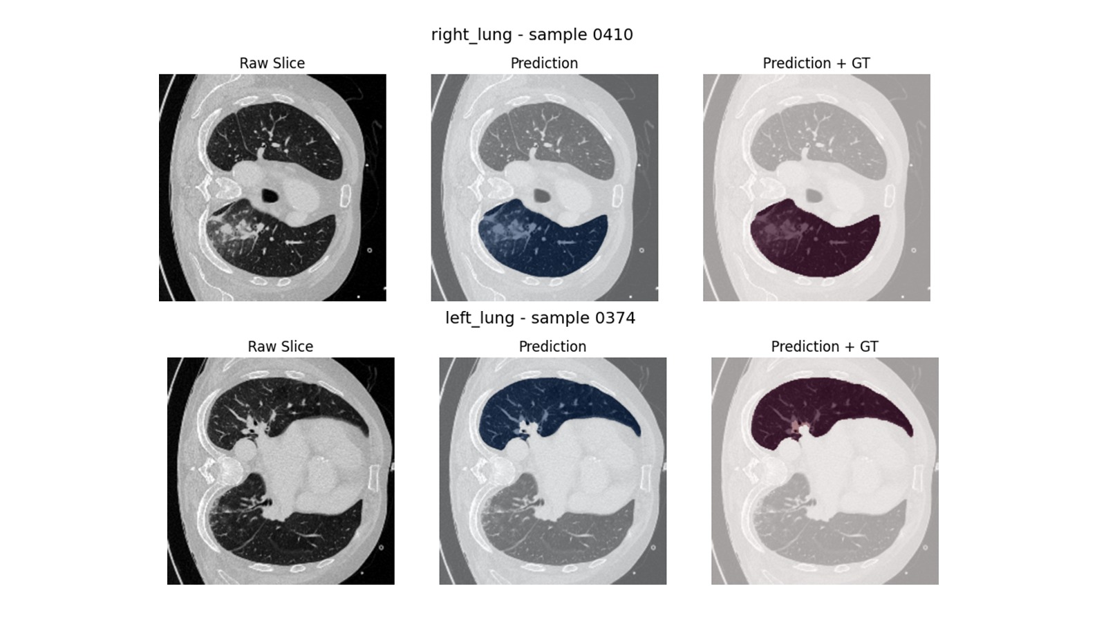 Lung Segmentation Results