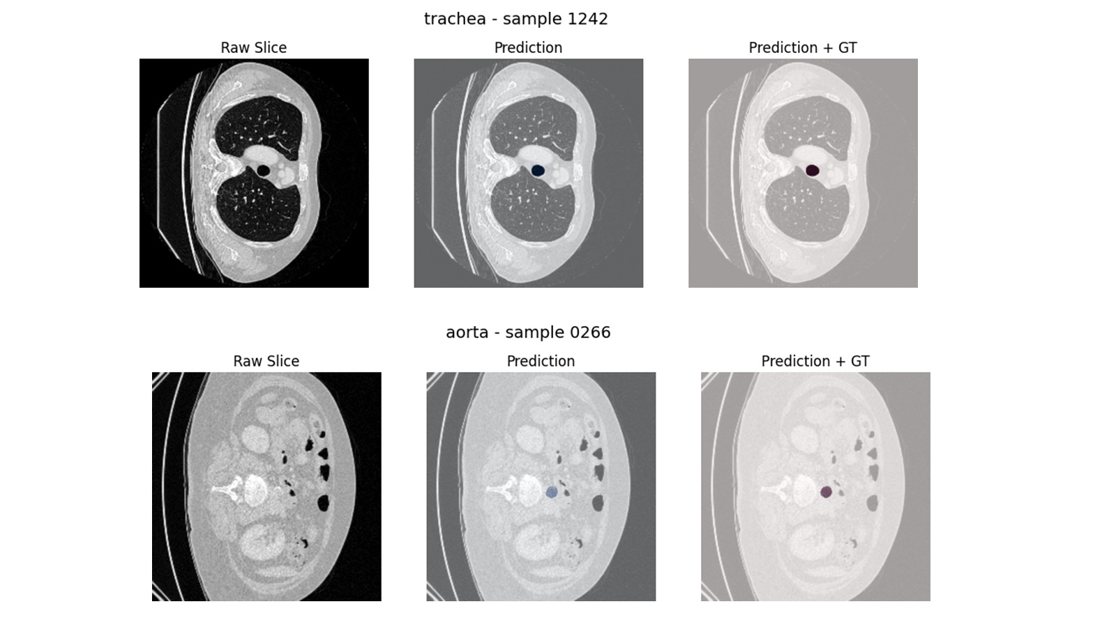 3D Organ Segmentation Visualization